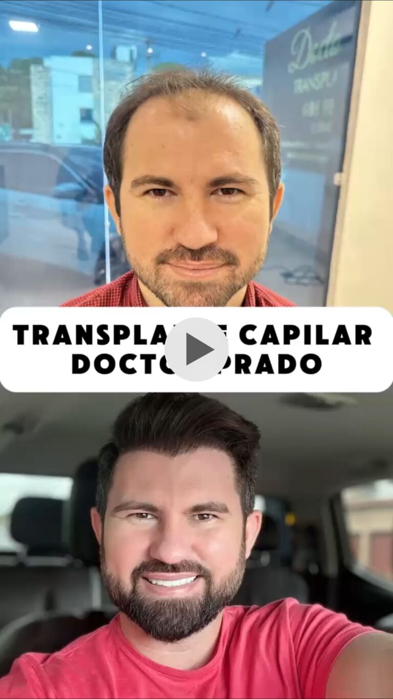 Instagram post from doctor.prado. This post is in position 19.