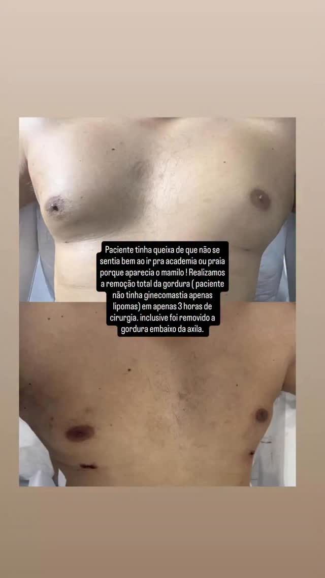 Instagram post from doctor.prado. This post is in position 1.